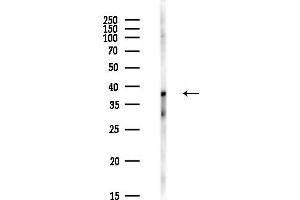 anti-Zinc Finger Protein 696 (ZNF696) antibody