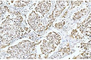 IHC analysis of Cyclophilin E/PPIE using anti-Cyclophilin E/PPIE antibody (ABIN7599242). (PPIE Antikörper  (AA 1-301))