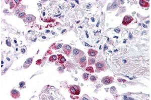 Human Lung: Formalin-Fixed, Paraffin-Embedded (FFPE) (EFHD1 Antikörper  (N-Term))
