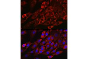 Immunofluorescence (IF) image for anti-Thioredoxin Interacting Protein (TXNIP) (AA 1-166) antibody (ABIN6149733)