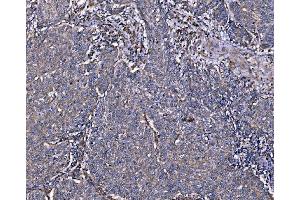 IHC analysis of Integrin Linked ILK using anti-Integrin Linked ILK antibody (ABIN7599411). (ILK Antikörper  (AA 1-452))