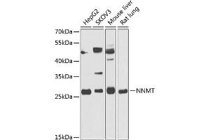 Western blot analysis of extracts of various cell lines, using NNMT antibody (ABIN6130587, ABIN6144695, ABIN6144697 and ABIN6218242) at 1:1000 dilution. (NNMT Antikörper  (AA 1-264))