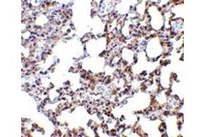 Immunohistochemistry (IHC) image for anti-SKI-Like Oncogene (SKIL) (N-Term) antibody (ABIN1031579) (SKIL Antikörper  (N-Term))