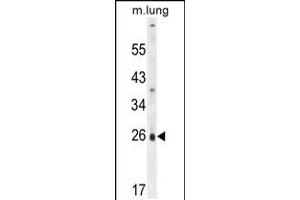 Western blot analysis in mouse lung tissue lysates (35ug/lane). (PQLC1 Antikörper  (AA 100-128))