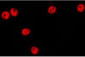 ABIN6275634 staining HepG2 by IF/ICC. (TCEAL1 Antikörper  (Internal Region))