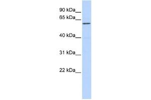 WB Suggested Anti-ZNF165 Antibody Titration:  0. (ZNF165 Antikörper  (Middle Region))