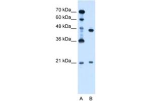Western Blotting (WB) image for anti-Ubiquitin-Conjugating Enzyme E2E 2 (UBE2E2) antibody (ABIN2462697) (UBE2E2 Antikörper)