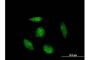 Immunofluorescence of purified MaxPab antibody to RAG2 on HeLa cell.