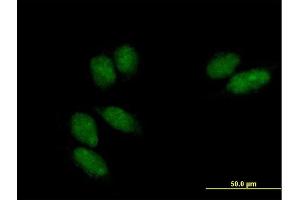 Immunofluorescence of purified MaxPab antibody to SSU72 on HeLa cell. (SSU72 Antikörper  (AA 1-194))