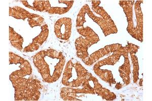 Formalin-fixed, paraffin-embedded human Prostate tissue stained with Annexin A1 Mouse Monoclonal Antibody (ANXA1/1671). (Annexin a1 Antikörper)