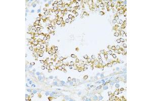 Immunohistochemistry of paraffin-embedded rat testis using DVL1 antibody (ABIN7266796) at dilution of 1:100 (40x lens). (DVL1 Antikörper  (AA 510-640))