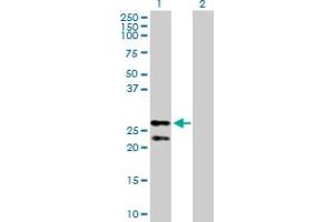 Western Blot analysis of PRDX3 expression in transfected 293T cell line by PRDX3 MaxPab polyclonal antibody. (Peroxiredoxin 3 Antikörper  (AA 1-256))