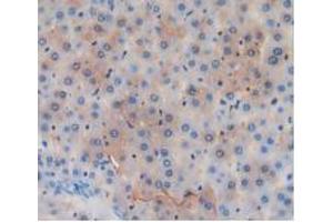 Figure. (GSTA4 Antikörper  (AA 2-222))