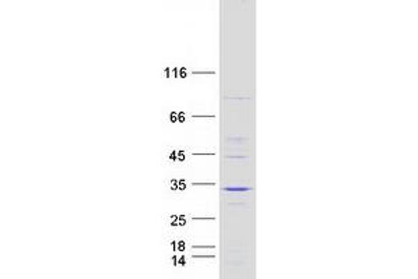 FAM109A Protein (Myc-DYKDDDDK Tag)