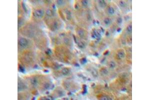 Used in DAB staining on fromalin fixed paraffin-embedded Liver tissue (MBL2 Antikörper  (AA 42-96))