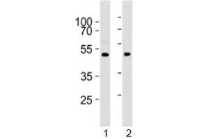 Western blot analysis of lysate from 1) human brain and 2) mouse brain tissue lysate using PRMT8 antibody at 1:1000. (PRMT8 Antikörper  (AA 344-373))
