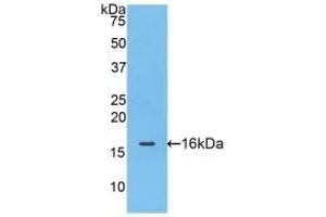 Detection of Recombinant FABP4, Mouse using Polyclonal Antibody to Fatty Acid Binding Protein 4 (FABP4) (FABP4 Antikörper  (AA 2-132))