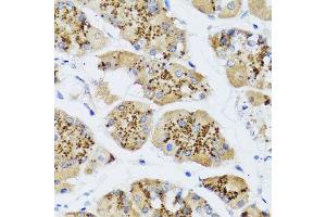 Immunohistochemistry of paraffin-embedded human gastric using CHIC2 antibody at dilution of 1:100 (x40 lens).