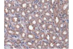 IHC-P analysis of Rat Kidney Tissue, with DAB staining. (CAMK2A Antikörper  (AA 1-478))