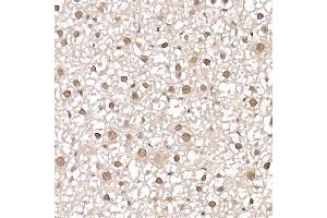Immunohistochemistry of paraffin-embedded mouse liver using [KO Validated] PRMT4/C Rabbit pAb (ABIN1682307, ABIN3015886, ABIN3015887 and ABIN6219468) at dilution of 1:25 (40x lens). (CARM1 Antikörper  (AA 409-608))
