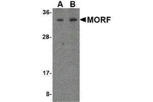 Western Blotting (WB) image for anti-Mortality Factor 4 (MORF4) antibody (ABIN2475740) (MORF4 Antikörper)