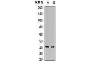 Western blot analysis of RRS1 expression in Hela (A), SHSY5Y (B) whole cell lysates. (RRS1 Antikörper)