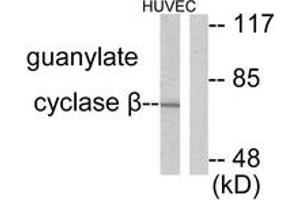 Western blot analysis of extracts from HuvEc cells, using Guanylate Cyclase beta Antibody. (GUCYB Antikörper  (AA 10-59))