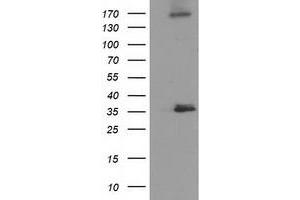 Western Blotting (WB) image for anti-Nudix (Nucleoside Diphosphate Linked Moiety X)-Type Motif 6 (NUDT6) antibody (ABIN1499864) (NUDT6 Antikörper)