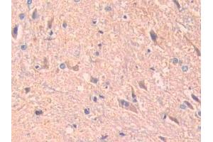 IHC-P analysis of Rat Spinal cord Tissue, with DAB staining. (ADAM10 Antikörper  (AA 218-445))