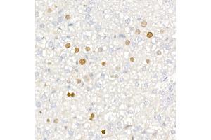 Immunohistochemistry of paraffin-embedded mouse liver using [KO Validated] CDKN1A/p21CIP1 Rabbit mAb (ABIN7266599) at dilution of 1:100 (40x lens). (p21 Antikörper)