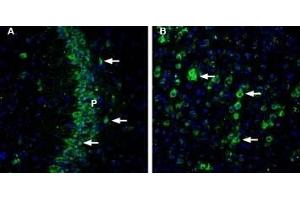 Expression of CHERP in mouse brain - Immunohistochemical staining of mouse brain sections using Anti-CHERP Antibody (ABIN7043011, ABIN7044119 and ABIN7044120). (CHERP Antikörper  (Cytosolic))
