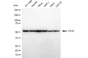 Western blotting analysis using CCT2 antibody (ABIN7798030).