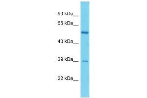Host: Rabbit Target Name: C19orf66 Sample Type: ACHN Whole cell lysates Antibody Dilution: 1. (C19ORF66 Antikörper  (N-Term))