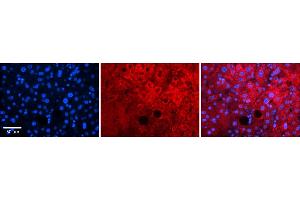 Rabbit Anti-Pard6b Antibody    Formalin Fixed Paraffin Embedded Tissue: Human Adult liver  Observed Staining: Cytoplasmic,Membrane Primary Antibody Concentration: 1:600 Secondary Antibody: Donkey anti-Rabbit-Cy2/3 Secondary Antibody Concentration: 1:200 Magnification: 20X Exposure Time: 0.