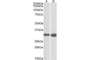 ABIN2564461 (0. (PDXP Antikörper  (C-Term))