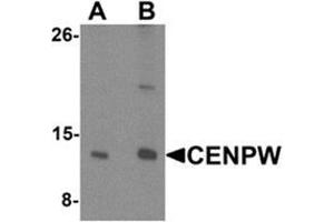 Western blot analysis of CENPW in HeLa cell lysate lysate with CENPW Antibody  at (A) 0. (CENPW Antikörper  (N-Term))