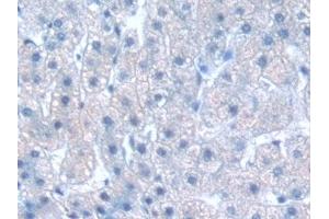 Immunohistochemistry (IHC) image for anti-Guanine Nucleotide Binding Protein (G Protein), beta Polypeptide 1-Like (GNB1L) (AA 69-247) antibody (ABIN7439600)