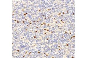 Immunohistochemistry of paraffin embedded mouse spleen using IL-23R (ABIN7074355) at dilution of 1:200 (400x lens) (IL23R Antikörper)