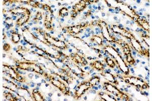 Anti-Cathepsin D Picoband antibody,  IHC(P): Mouse Kidney Tissue (Cathepsin D Antikörper  (AA 65-410))