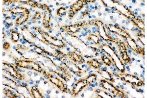 Anti-Cathepsin D Picoband antibody,  IHC(P): Mouse Kidney Tissue