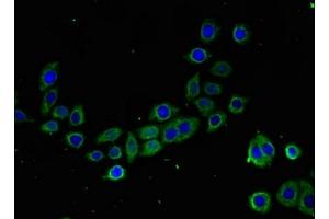 Immunofluorescent analysis of PC-3 cells using ABIN7172957 at dilution of 1:100 and Alexa Fluor 488-congugated AffiniPure Goat Anti-Rabbit IgG(H+L) (TMIGD2 Antikörper  (AA 23-150))