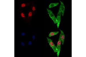 ABIN6262989 and ABIN6273053 staining Hela cells by IF/ICC. (Lamin B2 Antikörper  (Internal Region))