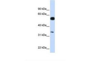 Image no. 1 for anti-BRISC and BRCA1 A Complex Member 1 (BABAM1) (AA 36-85) antibody (ABIN6749759)