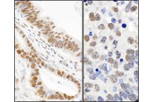 Immunohistochemistry (IHC) image for anti-Tumor Protein P53 Binding Protein 1 (TP53BP1) (pSer25) antibody (ABIN7453403)