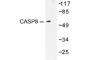 Image no. 1 for anti-Caspase 8 (CASP8) antibody (ABIN271875) (Caspase 8 Antikörper)