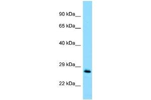 WB Suggested Anti-MOB1A Antibody Titration: 1. (MOB1A Antikörper  (Middle Region))