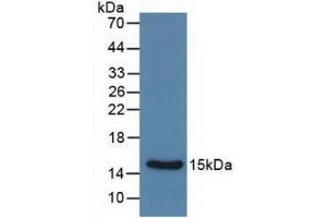 Detection of Recombinant Calcitonin, Rat using Monoclonal Antibody to Calcitonin (CT) (Calcitonin Antikörper  (AA 85-116))