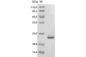 Tat (AA 1-86), (full length) protein (His tag)