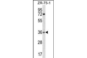 XRCC2 Antibody (N-term) (ABIN1882001 and ABIN2838361) western blot analysis in ZR-75-1 cell line lysates (35 μg/lane). (XRCC2 Antikörper  (N-Term))