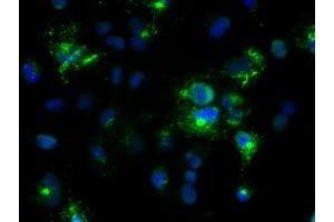 Anti-Nog mouse monoclonal antibody (ABIN2452361) immunofluorescent staining of COS7 cells transiently transfected by pCMV6-ENTRY Nog (RC205020). (NOG Antikörper  (AA 28-232))